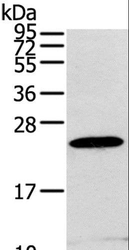 RGS1 Antibody