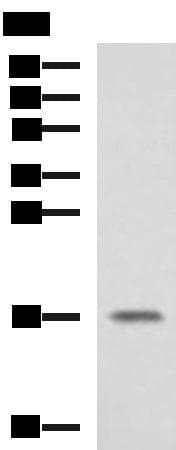 SRP14 Antibody
