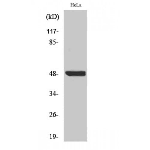 Polyclonal Rabbit anti-Human NFKBIB / IKB Beta / IKBB Antibody (phospho-Ser23, IHC, IF, WB)