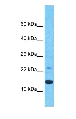 Polyclonal Rabbit anti-Human DNAJC15 Antibody (Internal, WB)