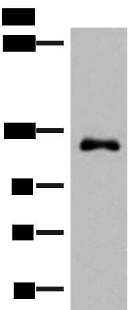 Polyclonal Rabbit anti-Human ARHGAP45 Antibody (WB)