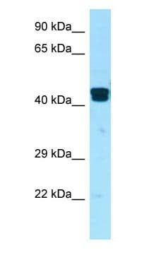 LIMS1 / PINCH Antibody (aa178-227)