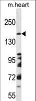 DCC Antibody (aa643-670)