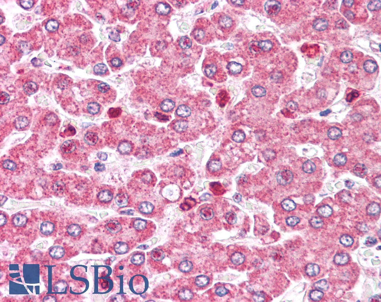 IHC-plus™ COMT Antibody (Internal)
