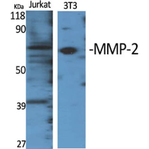 MMP2 Antibody (580-660 aa, C-terminal)