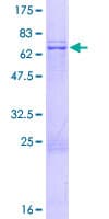 Human MRPS35 Protein (Recombinant GST)