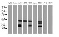 IHC-plus™ CD20 Antibody (clone 4B4)