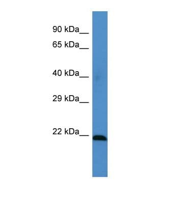 MSRA Antibody (aa45-94)