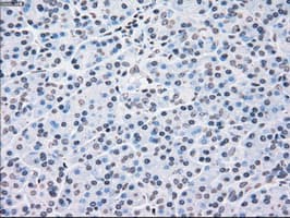 CHEK2 / CHK2 Antibody (clone OTI2H5)
