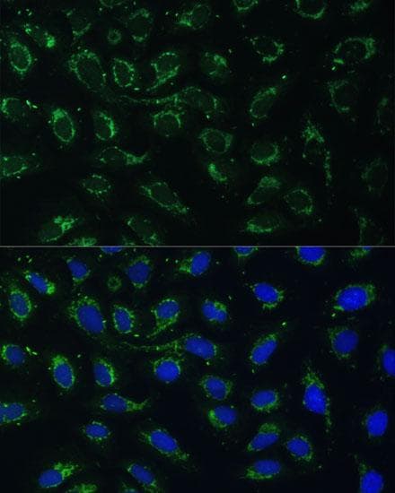 BABP / AKR1C2 Antibody