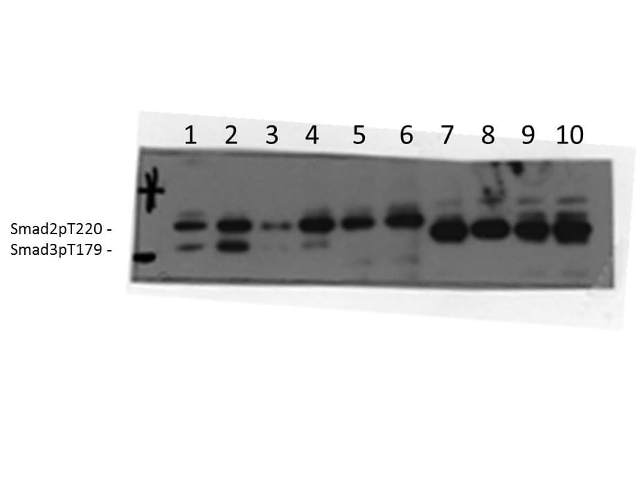 Polyclonal Rabbit anti-Human SMAD3 Antibody (aa179, Internal, WB)