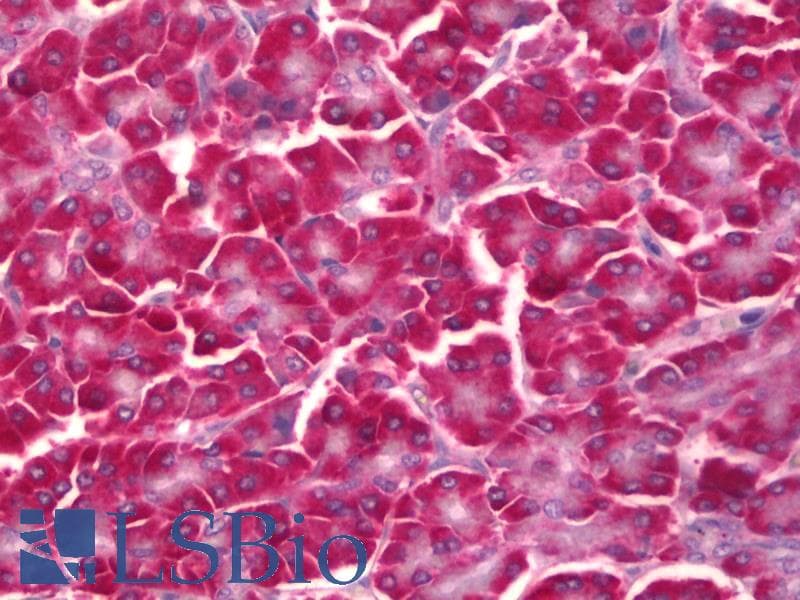 IHC-plus™ Monoclonal Mouse anti-Human EIF2S3 / EIF2G Antibody (clone 1H3, IHC, WB)