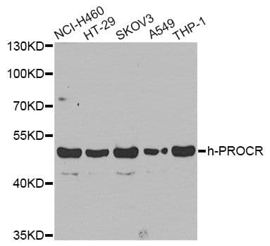 Polyclonal Rabbit anti-Human PROCR / EPCR Antibody (IHC, WB)