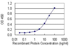 Monoclonal Mouse anti-Human ANK1 / Ankyrin Antibody (clone 3C3)