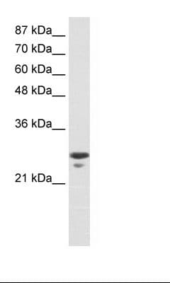 MtTFA / TFAM Antibody (aa75-124)