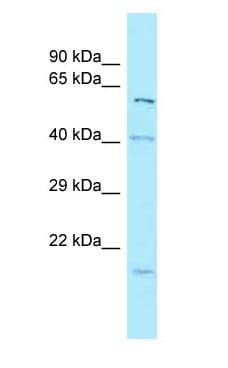 SNX1 Antibody (aa44-93)