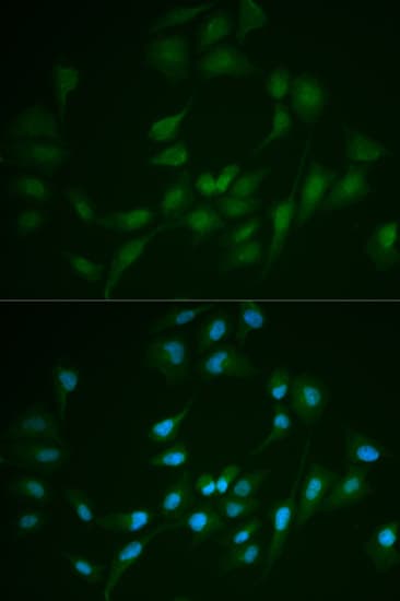 LIG1 / DNA Ligase 1 Antibody