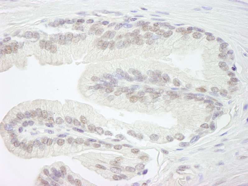 Polyclonal Rabbit anti-Human ARID1B / BAF250B Antibody (aa1850-1900, IHC)