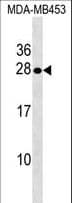 Polyclonal Rabbit anti-Human SPINT2 / HAI-2 Antibody (aa222-251, WB)