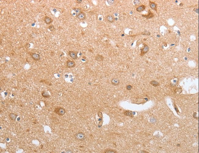 Polyclonal Rabbit anti-Human CASP12 / Caspase 12 Antibody (IHC)