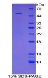 Human ANGPT4 / Angiopoietin-4 Protein (Recombinant His-GST)