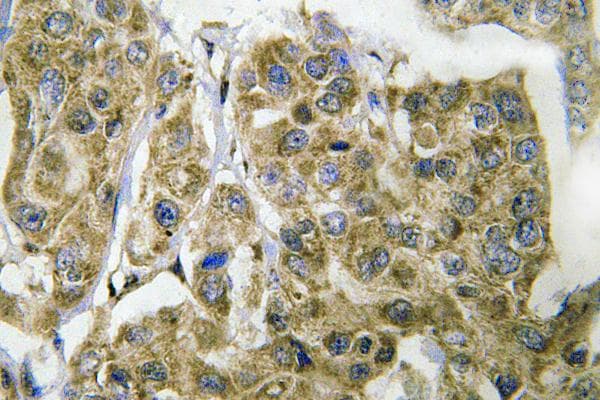 Polyclonal Rabbit anti-Human YAP / YAP1 Antibody (Gln295, IHC, IF, WB)