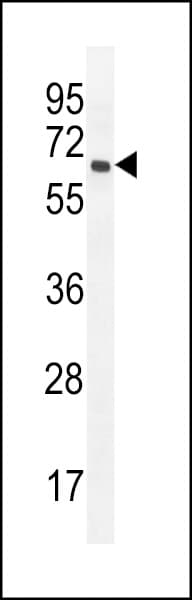 Polyclonal Rabbit anti-Human PRAMEF20 Antibody (aa394-423, WB)