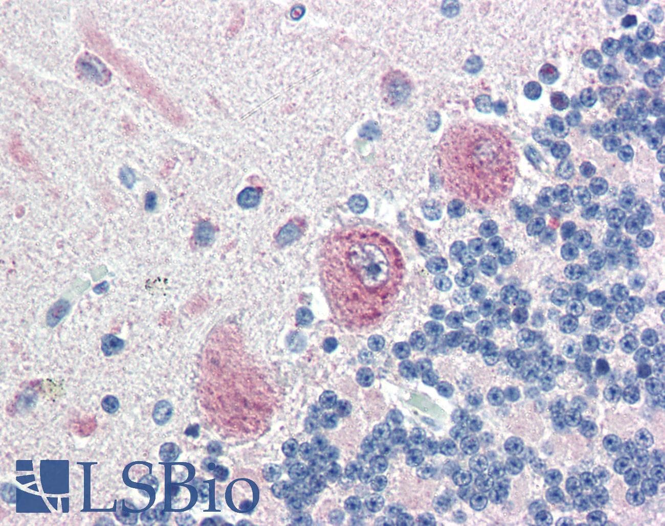 IHC-plus™ Polyclonal Rabbit anti-Human KIAA0152 / MLEC Antibody (N-Terminus, IHC)