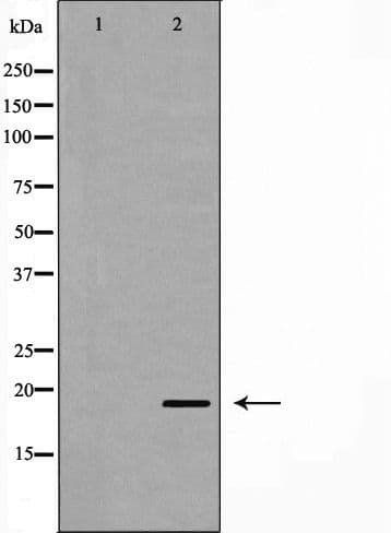 UBCH10 / UBE2C Antibody