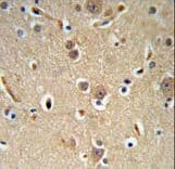 NEDD4 Antibody (aa1288-1319)