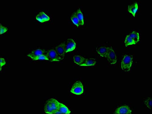 CORO1A / Coronin 1a Antibody