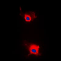 Polyclonal Rabbit anti-Human IRS1 Antibody (phospho-Ser636, IHC, IF, WB)