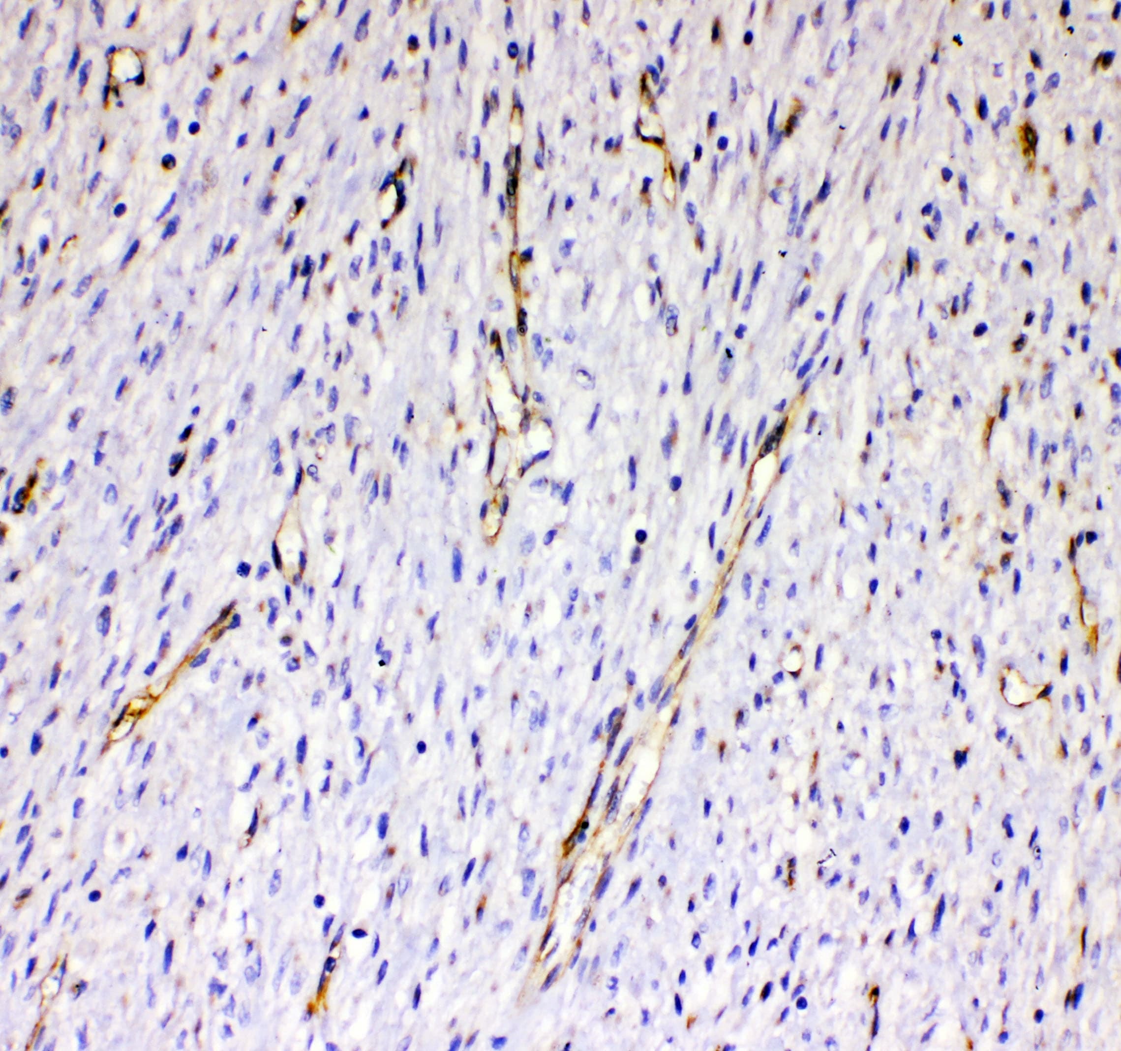 Polyclonal Rabbit anti-Human CD144 / CDH5 / VE Cadherin Antibody (WB)