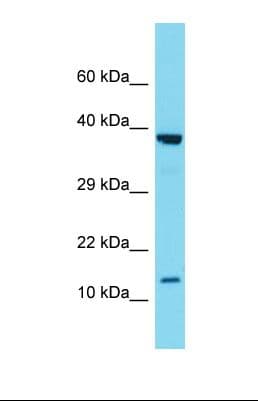 SCGB2A1 / Mammaglobin B Antibody (aa25-74)