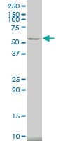 CAMK2A / CaMKII Alpha Antibody (clone 2C4)