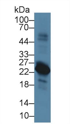 VPREB1 / CD179A Antibody (aa43-128)