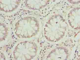 JAGN1 Antibody