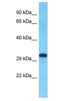 SLX1A / GIYD2 Antibody (aa13-62)