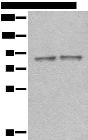 DDX1 Antibody