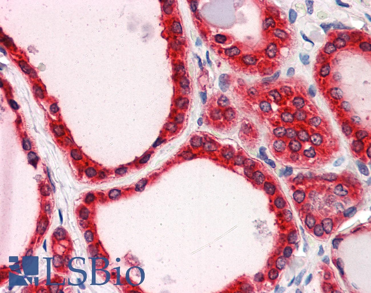TRIM33 / TIF1-Gamma Antibody (C-Terminus)
