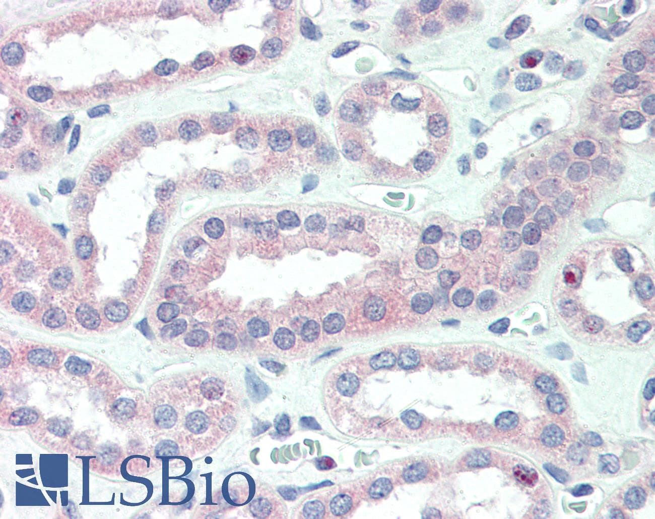 IHC-plus™ Polyclonal Rabbit anti-Human CRLF2 / TSLPR Antibody (IHC, IF, WB)