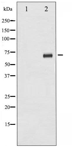 RPS6KB1 / P70S6K / S6K Antibody (phospho-Ser424)