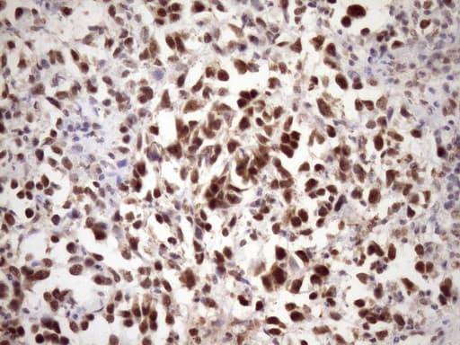 Monoclonal Mouse anti-Human WTAP Antibody (clone OTI12G6, aa2-106, IHC, WB)