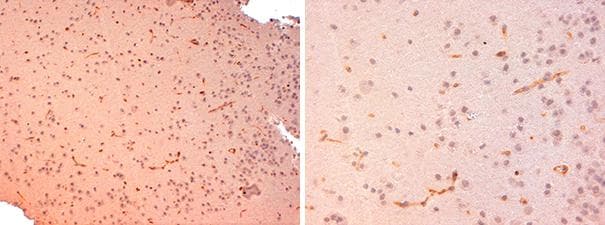 SLC2A1 / GLUT-1 Antibody