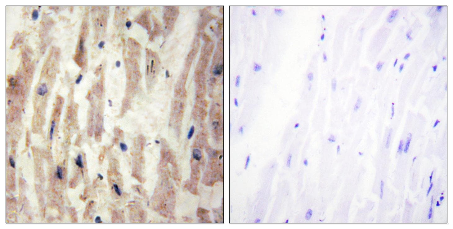 LAMA4 / Laminin Alpha 4 Antibody