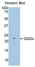 PYGM Antibody (aa11-187)