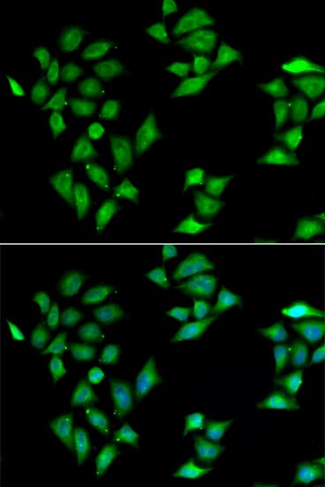 ITLN1 / Omentin Antibody