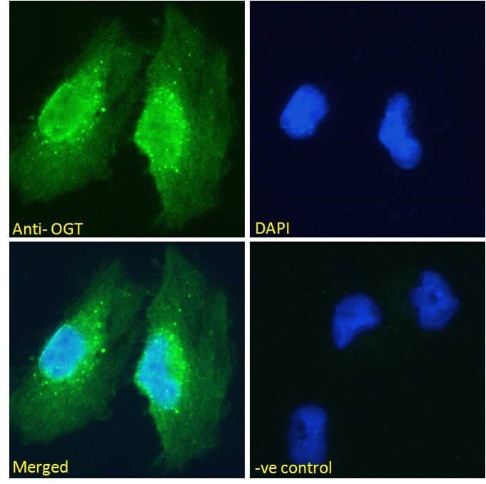 IHC-plus™ OGT / O-GLCNAC Antibody (aa543-555)