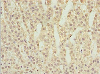 POC1A / SOFT Antibody