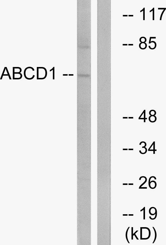 Polyclonal Rabbit anti-Human ALDP / ABCD1 Antibody (WB)